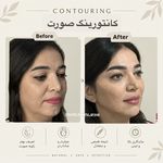 مرکز لیزر ،پوست و زیبایی کندی بیوتی