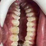 دندانپزشکی دکتر پریا آقاخانی(اقساط)