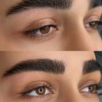 میکروبلیدینگ میناسلمانی