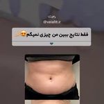 کلینیک تخصصی لاغری موضعی ولافیت