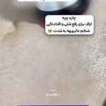 کلینیک تخصصی لاغری موضعی ولافیت