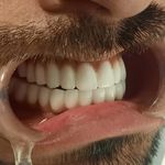 دندانپزشکی ایمپلنت و کلیه خدمات