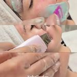 زیبایی صورت پاک سازی فیشیال سم زدایی یار