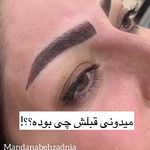خدمات فوق تخصصی میکرو ماندانا