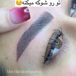 خدمات فوق تخصصی میکرو ماندانا