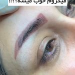 خدمات فوق تخصصی میکرو ماندانا