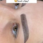 خدمات فوق تخصصی میکرو ماندانا