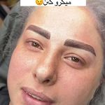 خدمات فوق تخصصی میکرو ماندانا