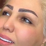 خدمات فوق تخصصی میکرو ماندانا