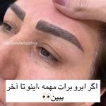 خدمات فوق تخصصی میکرو ماندانا
