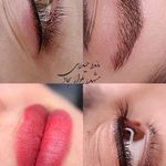 میکروبلیدینگ و شیدینگ و تتو مائده حیدری