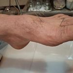 مطب طب سوزنی و حجامت دکتر سیفی