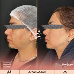 مرکز پزشکی و زیبایی میروژ سنتر