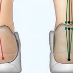 ارتوپدی فنی نبض حرکت، اسکن کف پا،کفی طبی