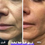 کلینیک پوست،مو،زیبایی،مرکز لیزر ‌پرنسا
