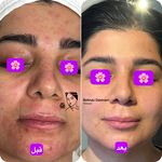 مرکز حرفه ای پوست و مو بهناز دست ورز