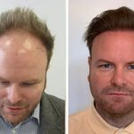 کلینیک کاشت ابرو مو و زیبایی دکتر ایرجی