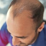 کلینیک زیبایی و کاشت مو تخصصی دنسا
