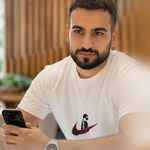 کاشت مو به روش سوپرمیکروگرفت