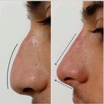 کلینیک ژل بوتاکس لیزر فیل بیوتی