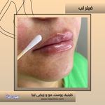 مطب پوست مو زیبایی فردوس شرق