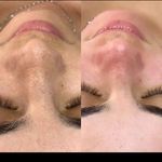 پاکسازی پوستShirzad_skincare