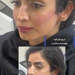 کلینیک زیبایی فریحا(پوست و مو)