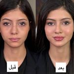 کلینیک پوست وزیبایی ومرکز تخصصی فیلربادی