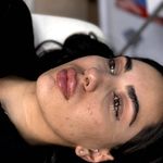 کلینیک تخصصی لیزر موهای زائد پریناز شرق