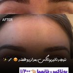 مرکز لیزر و کلینیک زیبایی پریفا