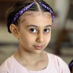 بافت مو درسا