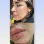 فیشال درمانی و پاکسازی پوست میرجلیلی