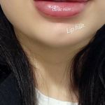 کلینیک لیزر و زیبایی الیزه اهواز