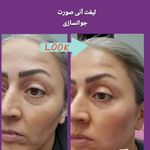 مرکز لیزر و کلینیک زیبایی زرین