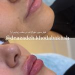 مطب زیبایی آرا
