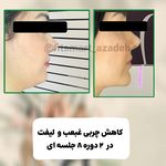 مرکز لاغری موضعی و ایکس بادی فیت اسمارت