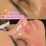 کلینیک فیشال و ماساژ سارن اسکین سارا