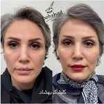 کلینیک تخصصی پوست و‌زیبایی بهشاد