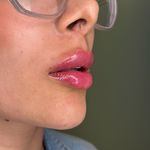 کلینیک زیبایی رامارز