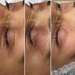 فیشال و پاکسازی پوست درنواب