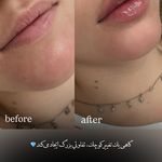 مرکز لیزر و کلینیک زیبایی پریفا