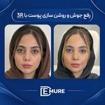 مرکز تخصصی زیبایی و جوانسازی دمور