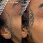 کلینیک زیبایی و لیزر دکتر آزاده اسماعیلی