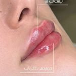 کلینیک زیبایی و لیزر سلن مشهد