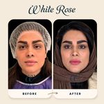 کلینیک زیبایی رز سفید