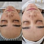 خدمات تخصصی پاکسازی پوست رویال اسکین