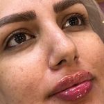 کلینیک پوست سلین - کلینیک پوست و مو - شهر شیراز - 0030