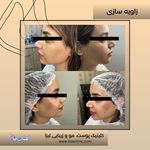 مطب پوست مو زیبایی فردوس شرق