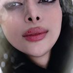 مطب زیبایی دکتر مصطفی کریمی