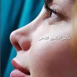 فوق تخصص جراحی زیبایی و بینی دکتر فتحی